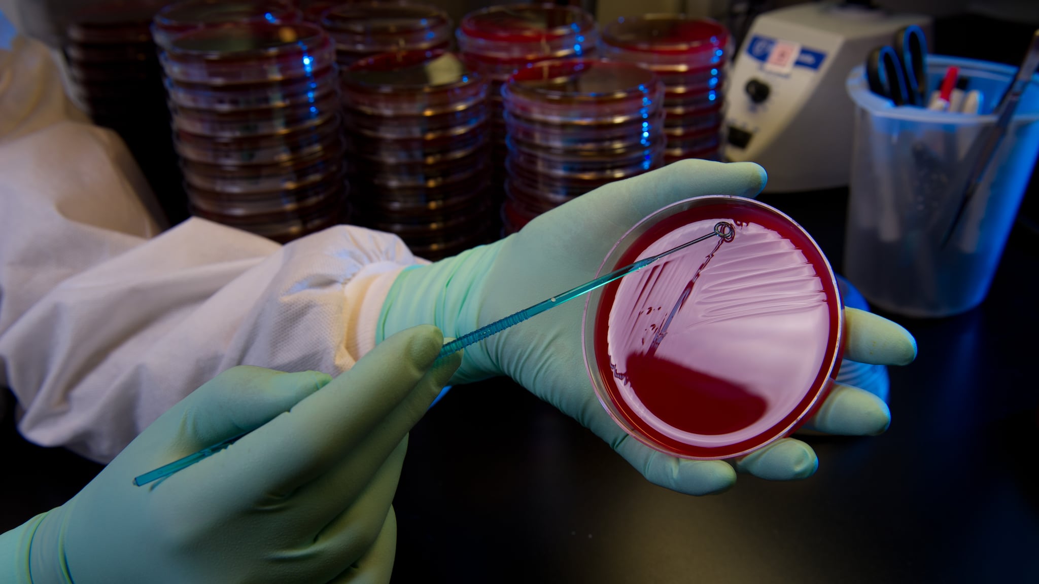 Culture of Streptococcus Lab staff culture Streptococcus.