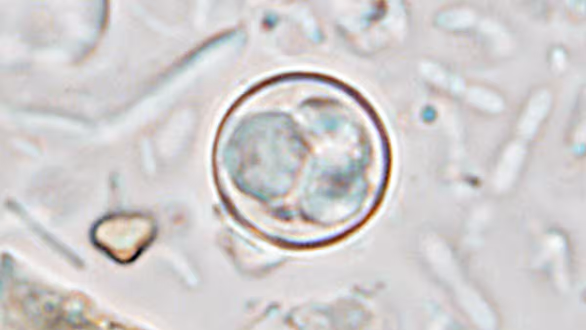 Oocsyt Cyclospora Magnified image of a parasite inside circular shell