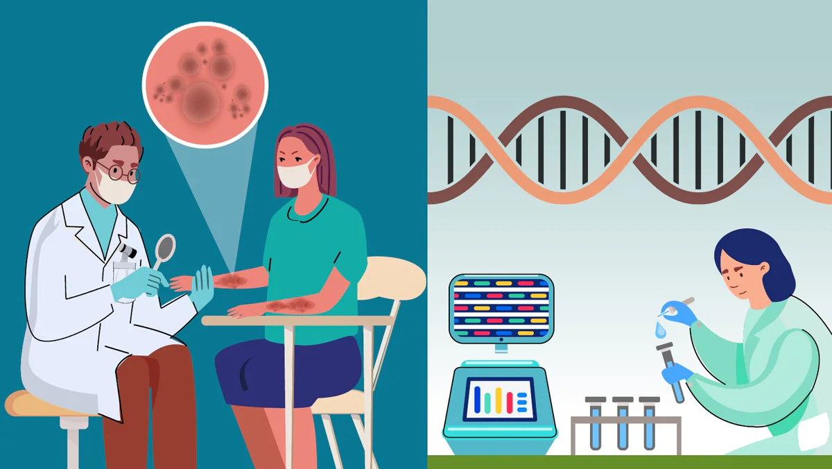 ringworm Illustration of doctor examining ringworm on a patint's skin and a scientist sequencing dna from a sample