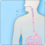 Illustration of how gastrointestinal anthrax occurs through eating raw or undercooked meat from an infected animal.