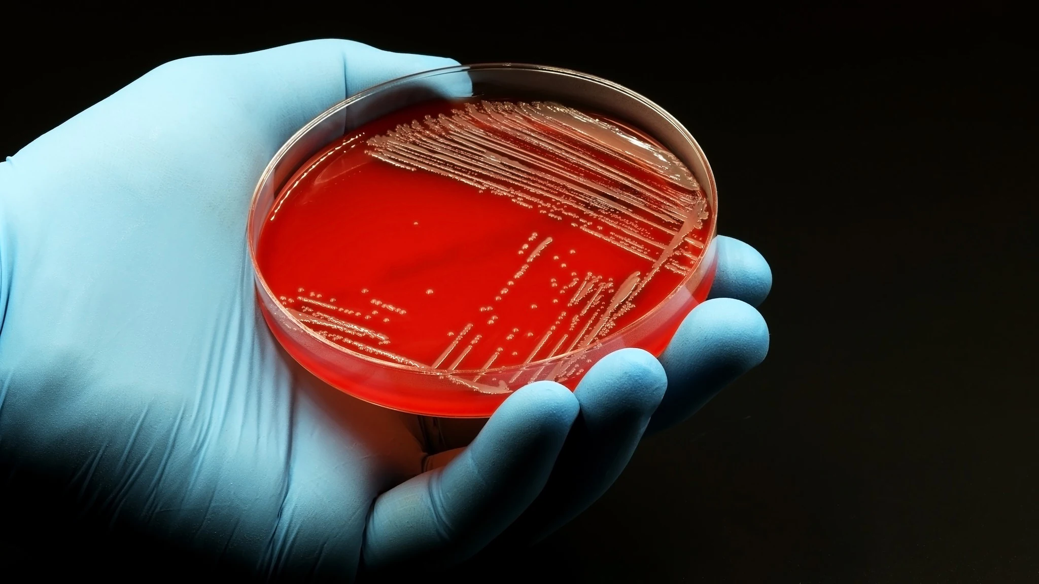 Culture A hand with a blue glove on holding a petri dish with bacteria growing on its red medium inside.