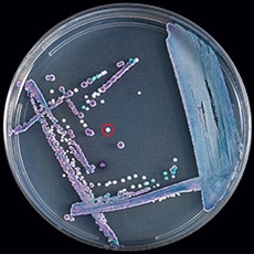 Artificiallymixedplate230px.png Petri dish with mixed culture ofCandida glabrata (purple), Candida tropicalis (navy blue), and Candida auris (white, circled in red) on CHROMagar Candida.