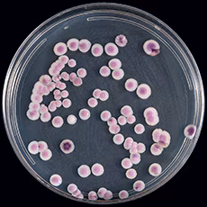 Candida auris on CHROMagar Candida, here, for example, displays multiple color morphs.