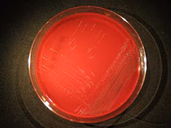 Capnocytophaga species are fastidious, slow-growing, Gram-negative bacteria.