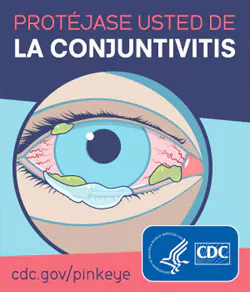 Protejase usted de la conjuntivitis (Spanish) Protejase usted de la conjuntivitis (Spanish)