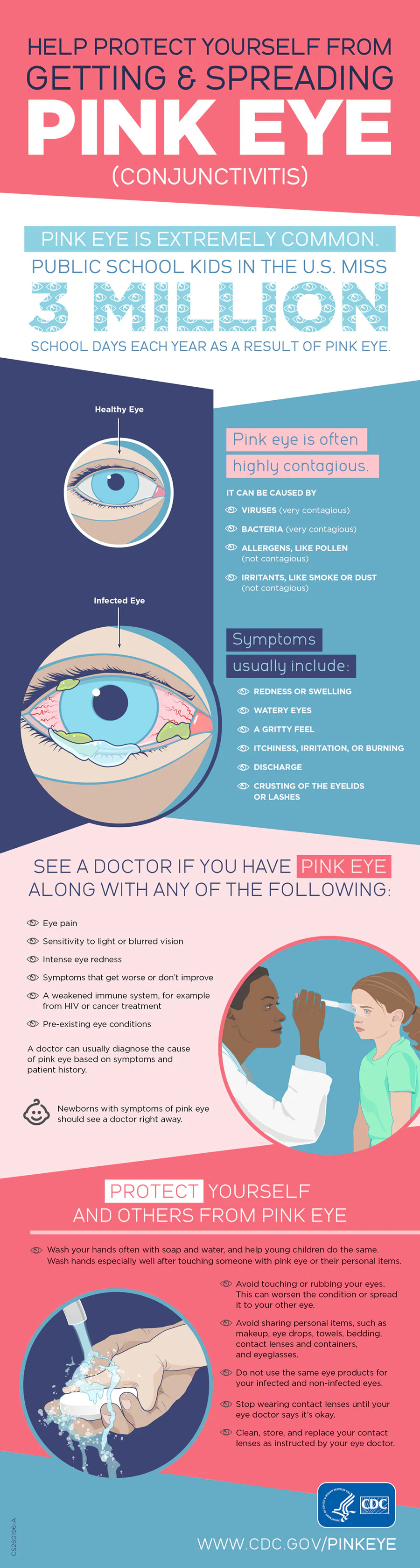 Help protect yourself from pink eye infographic Infographic about how to help protect yourself from getting and spreading pink eye (conjunctivitis).