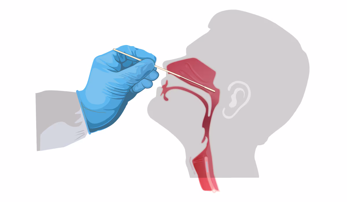 nasal-swab Illustration: swab inserted into nasal cavity