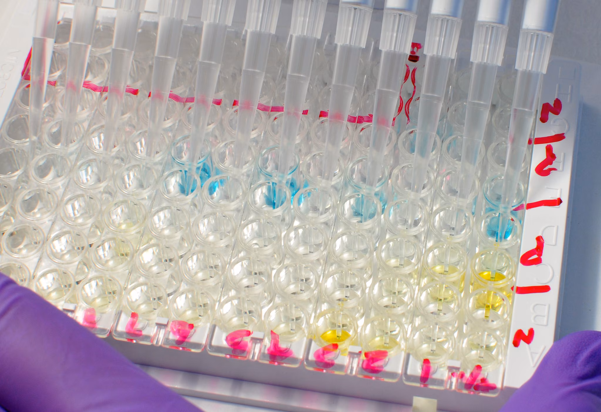 An image of test tubes lined up in a test tray.