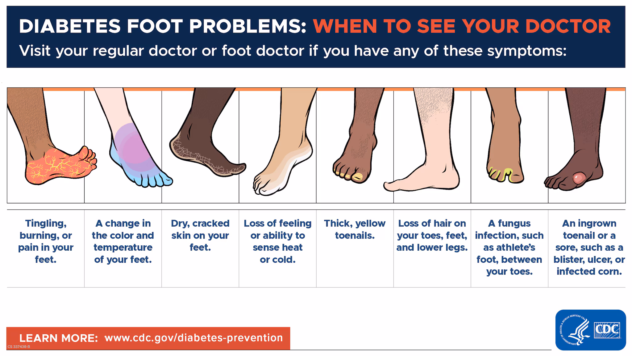 Foot-Symptoms-1200x675 Diabetes Foot Problems - Visit your regular doctor or foot doctor if you have any of these symptoms.