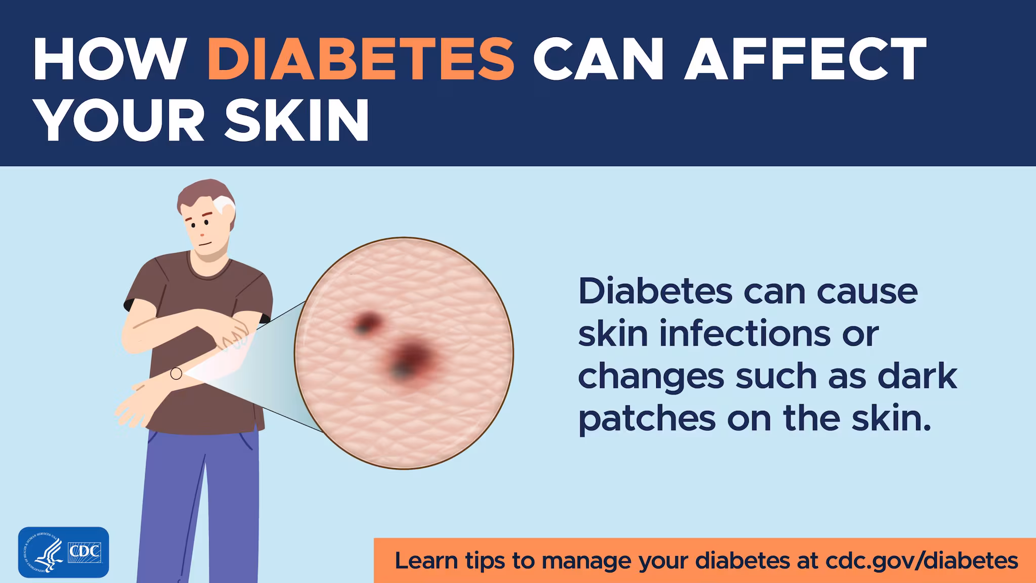 A close-up of a man’s skin showing dark patches.