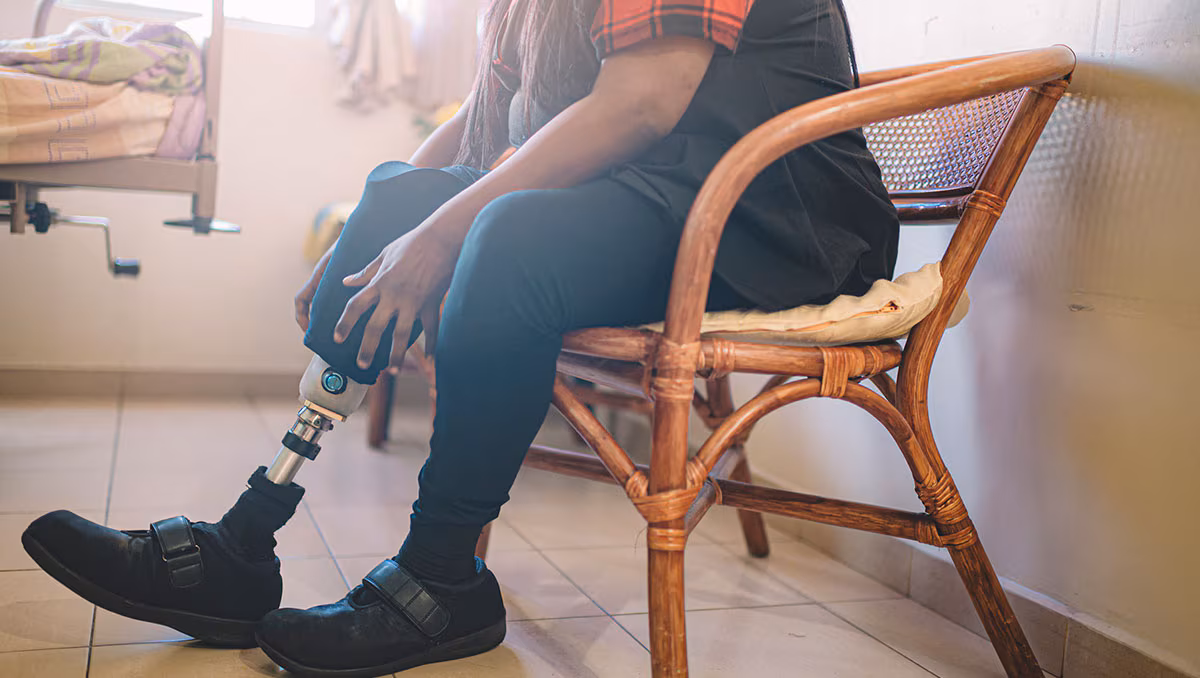 An Asian Indian person with prosthetic leg adjusting her artificial limb at hospital ward person with prosthetic leg adjusting artificial limb