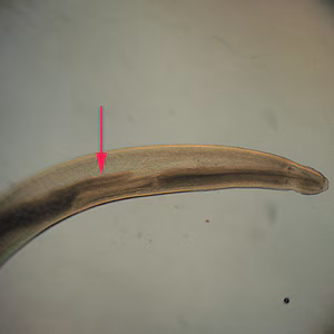 Pseudoterranova sp. larval worms.