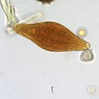 January - 2005 - Case #148