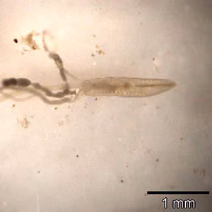 March - 2005 - Case #151