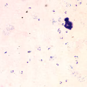 April - 2005 - Case #153