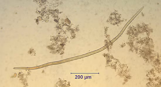 May - 2005 - Case #155