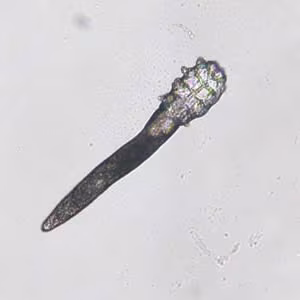 July - 2005 - Case #159