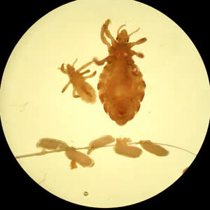 August - 2005 - Case #162