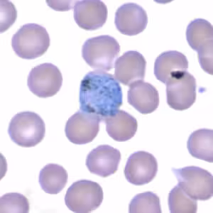 October - 2005 - Case #165