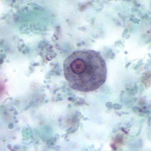 November - 2005 - Case #167