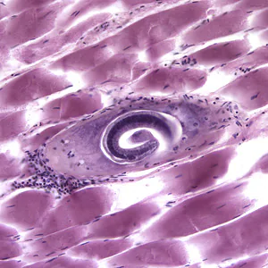 December - 2005 - Case #170