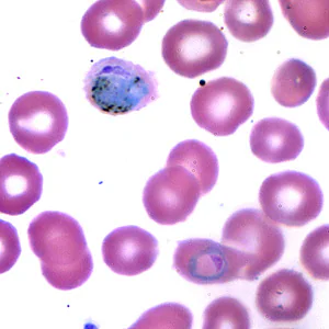 February - 2006 - Case #173