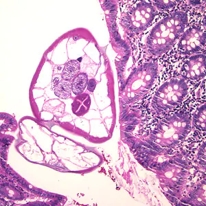 February - 2006 - Case #174