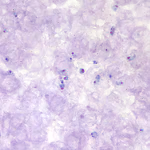 April - 2006 - Case #177