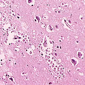 June - 2006 - Case #181