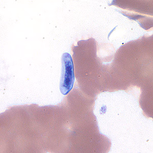 July - 2006 - Case #184