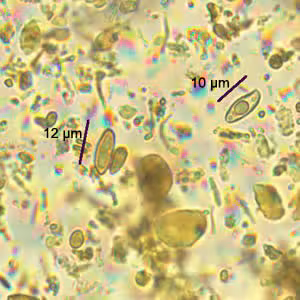 August - 2006 - Case #186