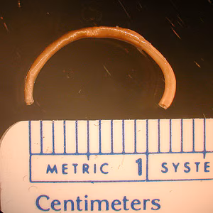 Case189_A.jpg Case189_A