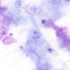 October - 2006 - Case #190