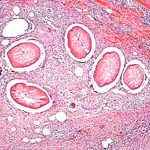 December - 2006 - Case #193