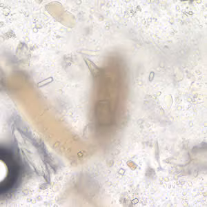 Case196_B.jpg Case196