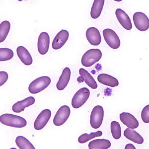 February - 2007 - Case #197