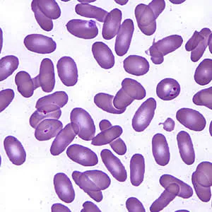 Case197_C.jpg Case197