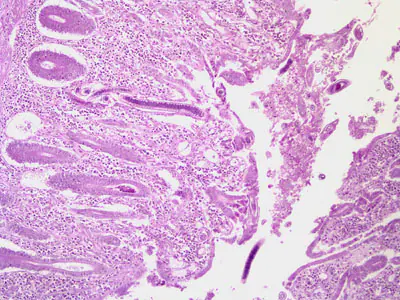 April - 2007 - Case #201