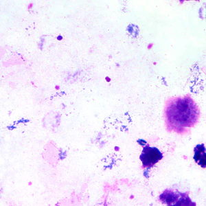 Case203_A.jpg Case203