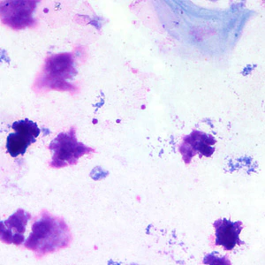 Case203_B.jpg Case203