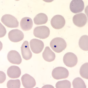 Case203_C.jpg Case203