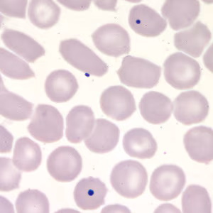 Case203_D.jpg Case203