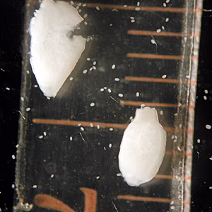 May - 2007 - Case #204