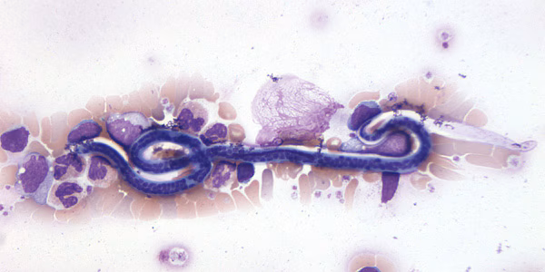 June - 2007 - Case #206