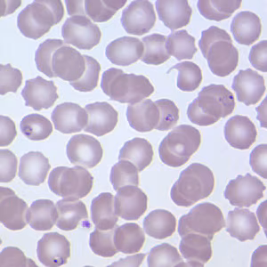 August - 2007 - Case #209