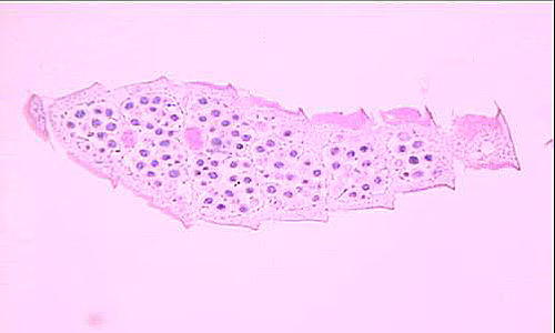 September - 2007 - Case #212