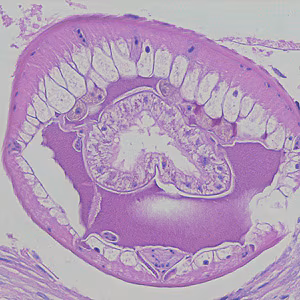 Case215_A.jpg Case215