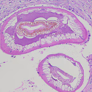 Case215_B.jpg Case215