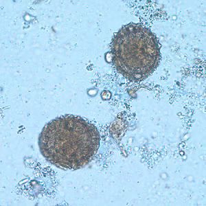 Case216_B.jpg Case216