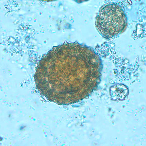 Case216_D.jpg Case216